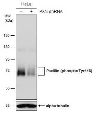 Western Blot: Paxillin [p Tyr118] Antibody [NBP3-13073]